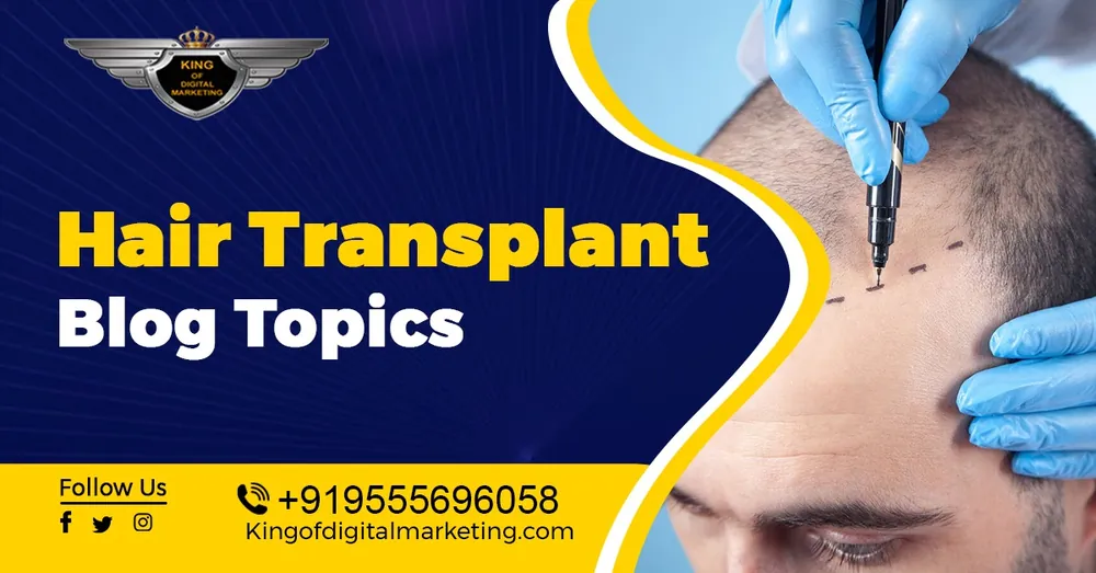 Top Blog Ideas For Hair Transplant : Hair Transplant Blog Topics