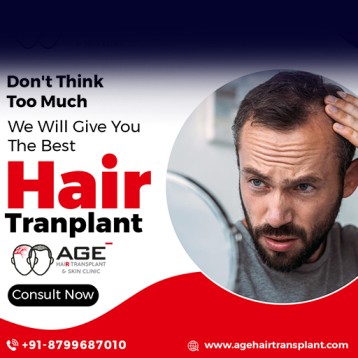 Age Hair Transplant